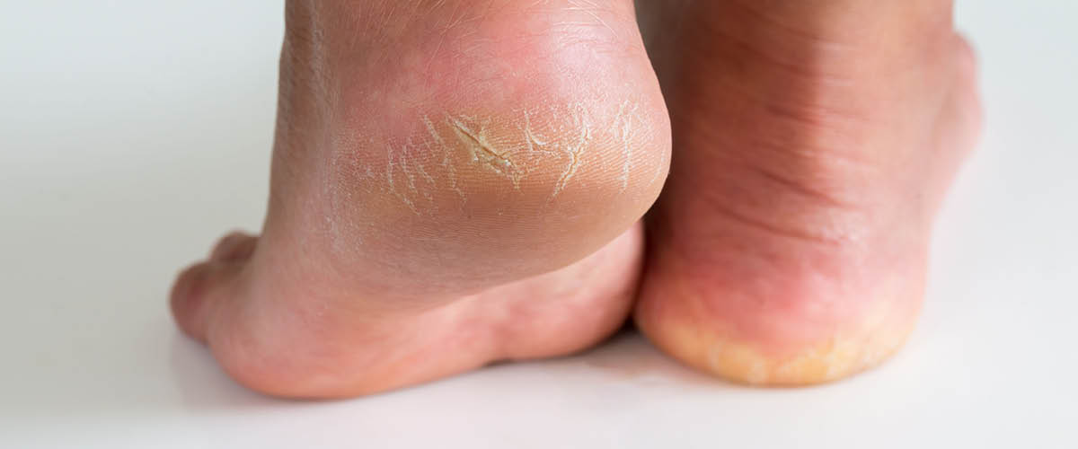 moisturising baby skin